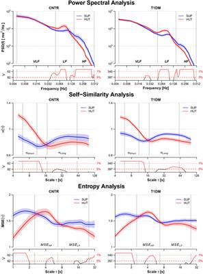 Heart Rate Variability for the Early Detection of Cardiac Autonomic Dysfunction in Type 1 Diabetes